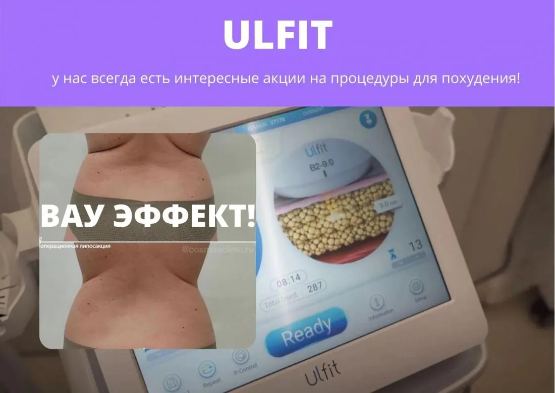 Ультразвуковая кавитация