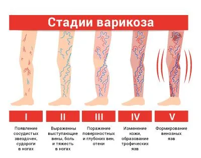 Безопасна ли процедура?