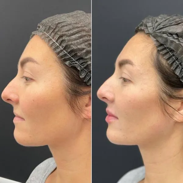 Full Face