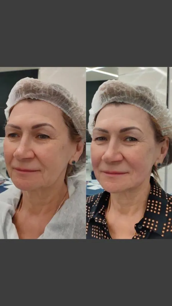 Full Face
