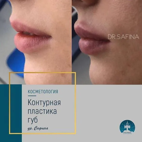 Губы