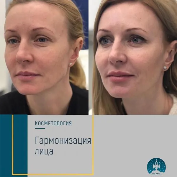 Бьютификация