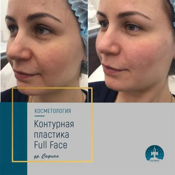 Full Face