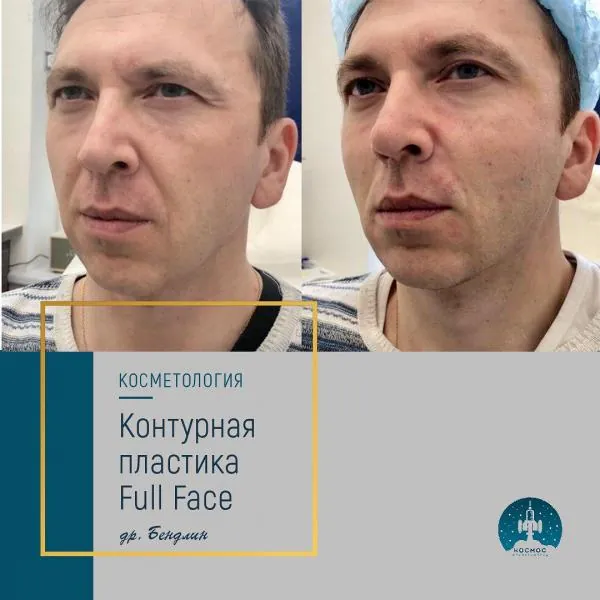 Full Face