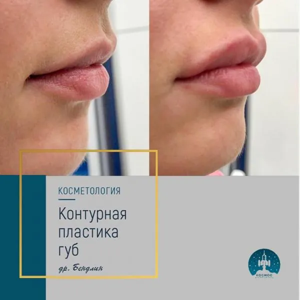 Губы