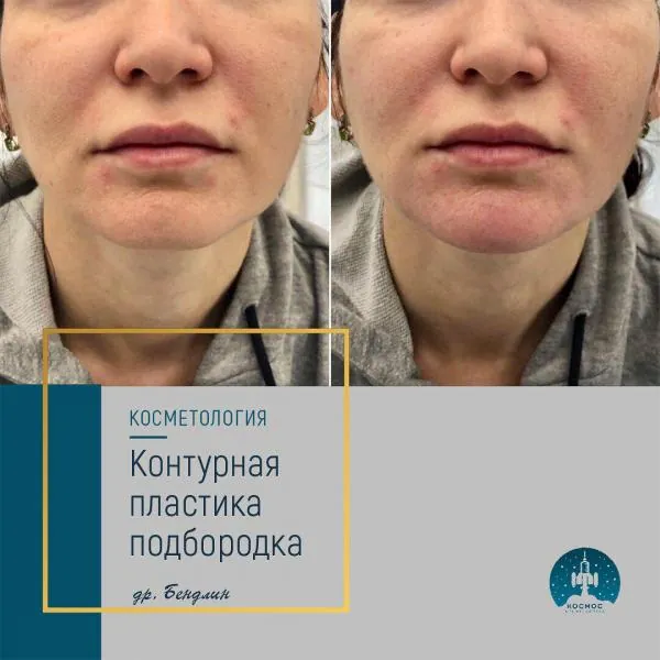 Подбородок