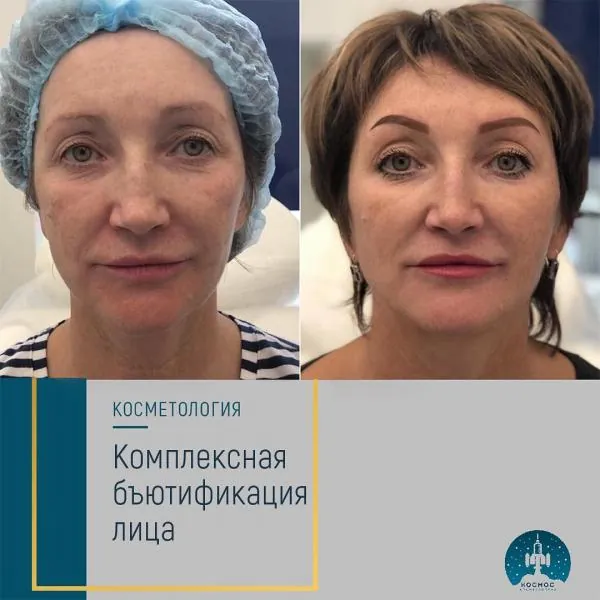 Бьютификация