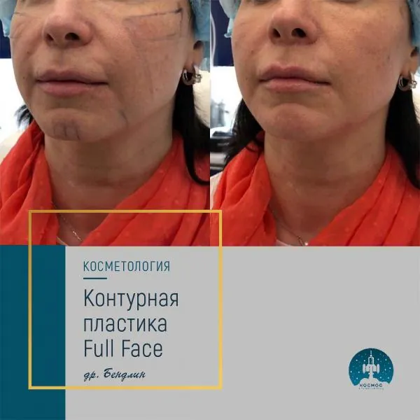 Full Face