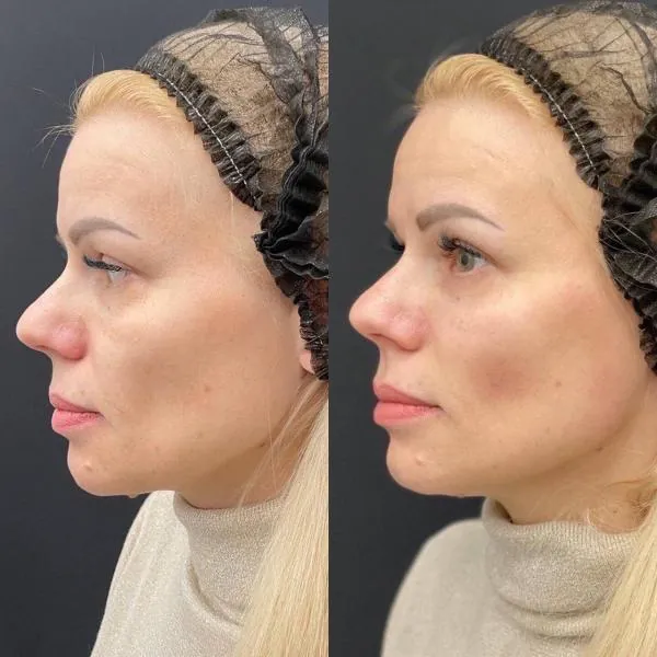 Full Face