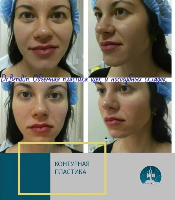 Объемная пластика