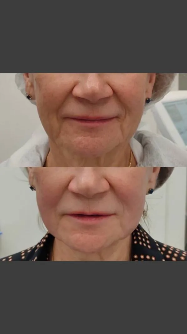 Full Face