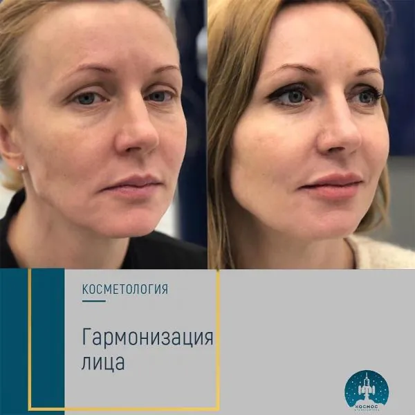 Бьютификация