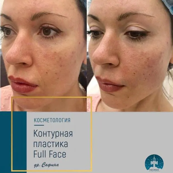 Full Face