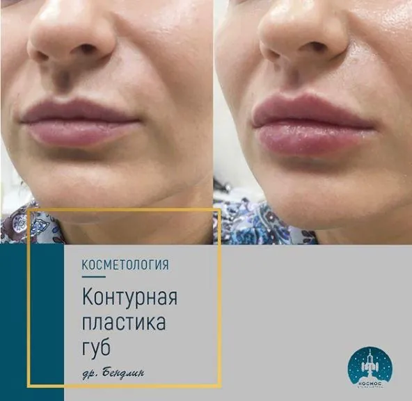 Губы