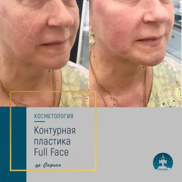 Full Face