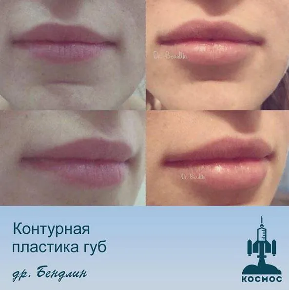 Губы