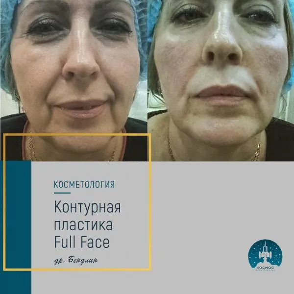 Full Face