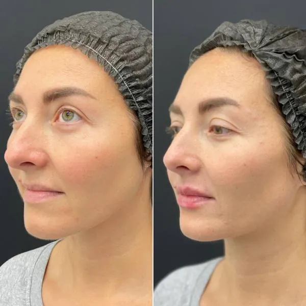 Full Face