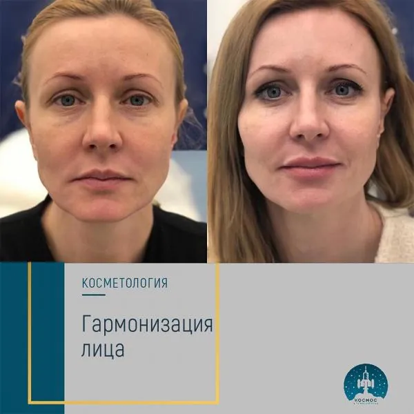 Бьютификация