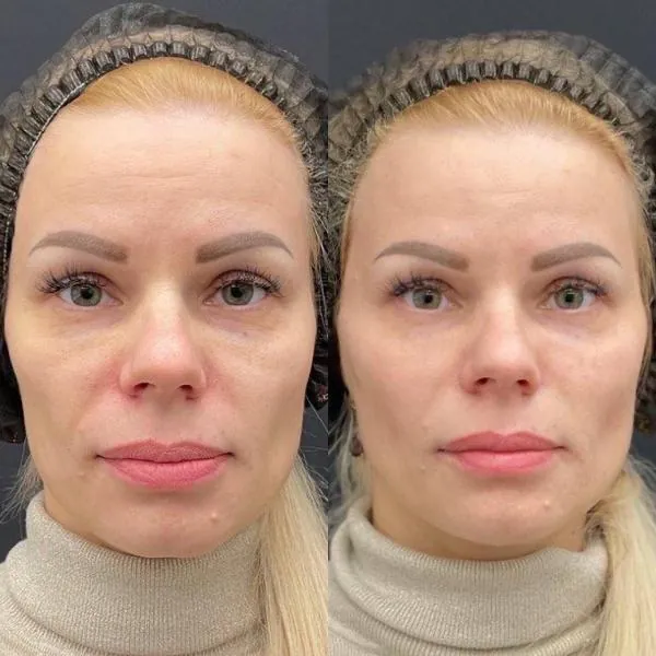 Full Face