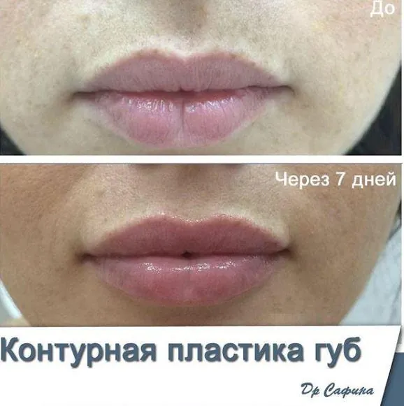 Губы
