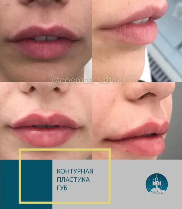 Губы