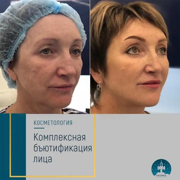 Бьютификация