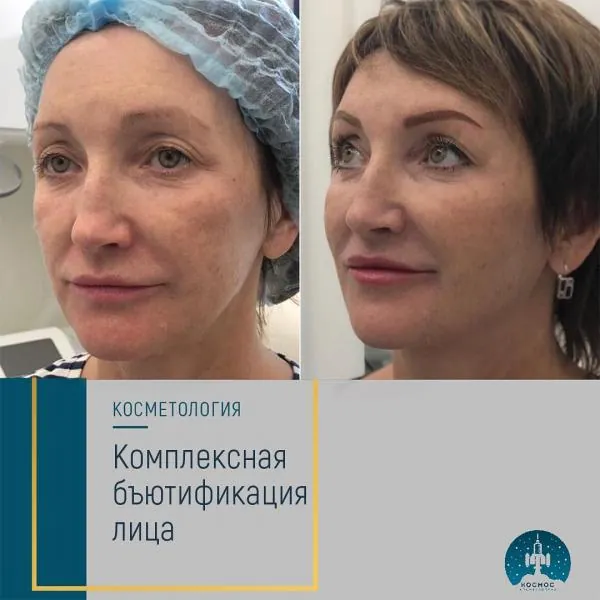 Бьютификация