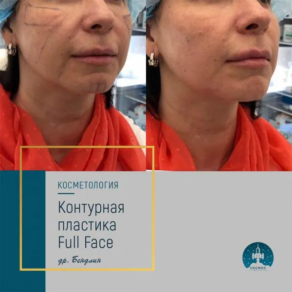 Full Face