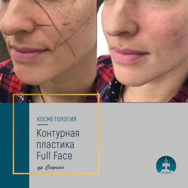 Full Face