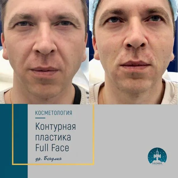 Full Face