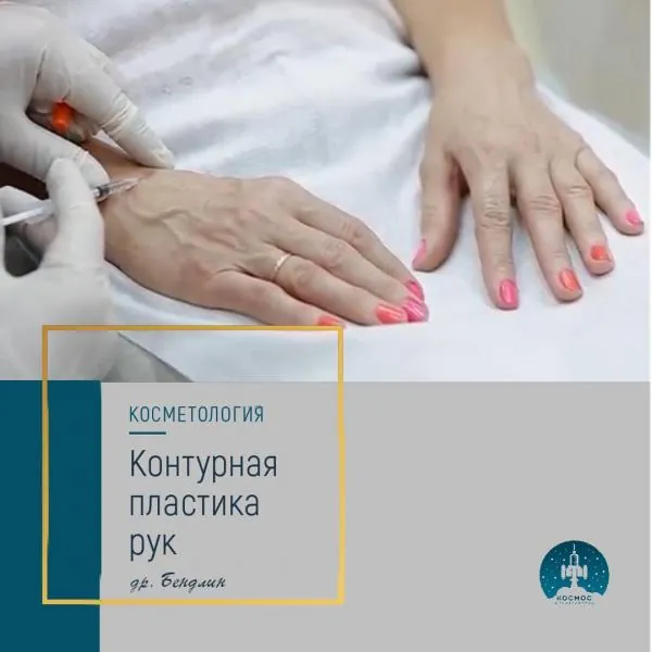 Руки