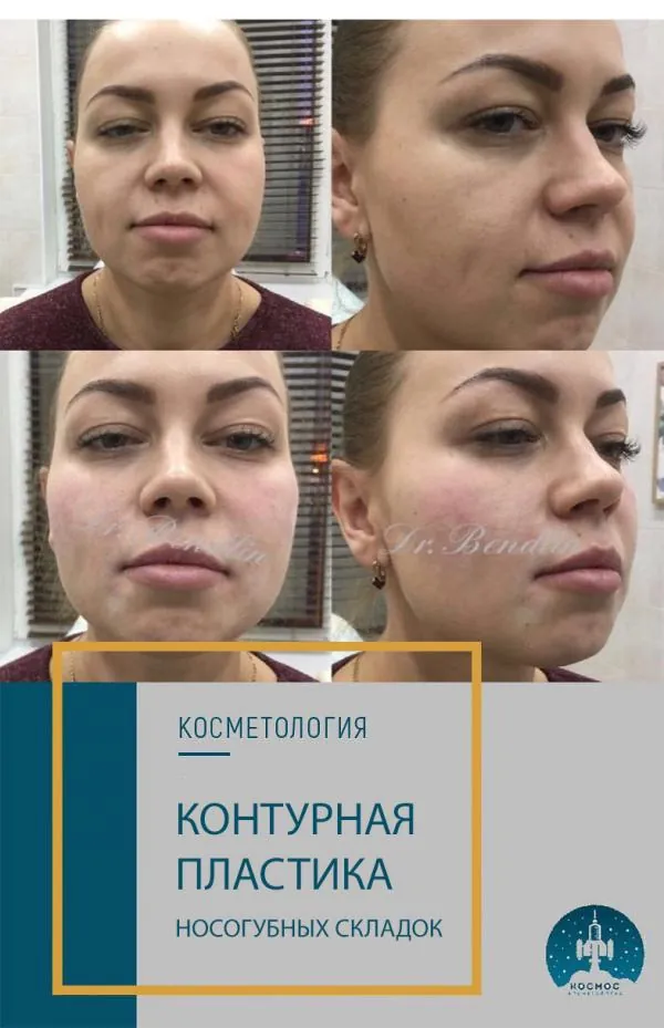 Фото до и после