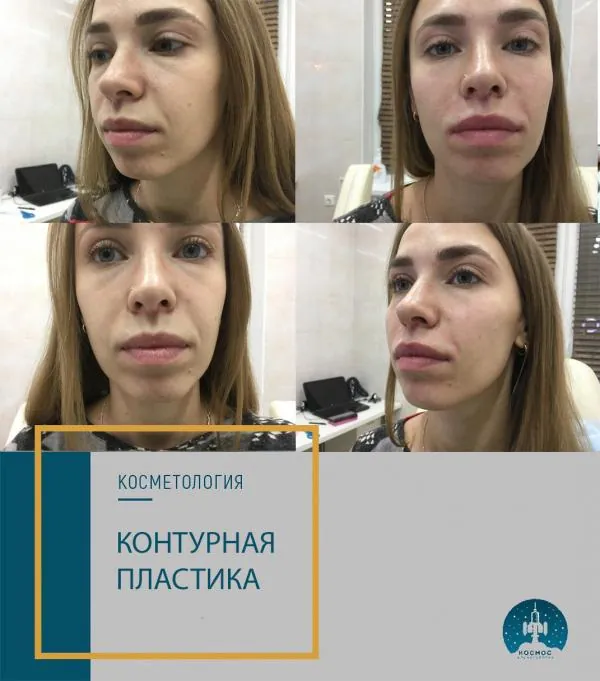 Фото до и после