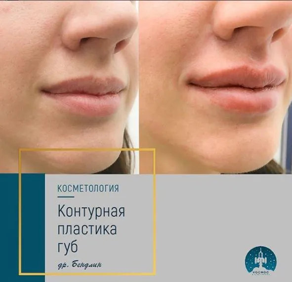 Губы