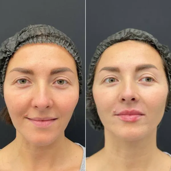 Full Face