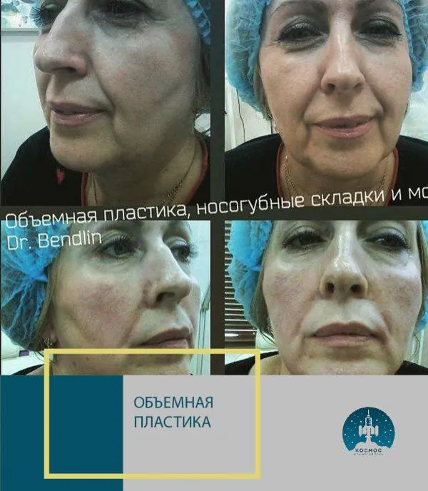 Объемная пластика