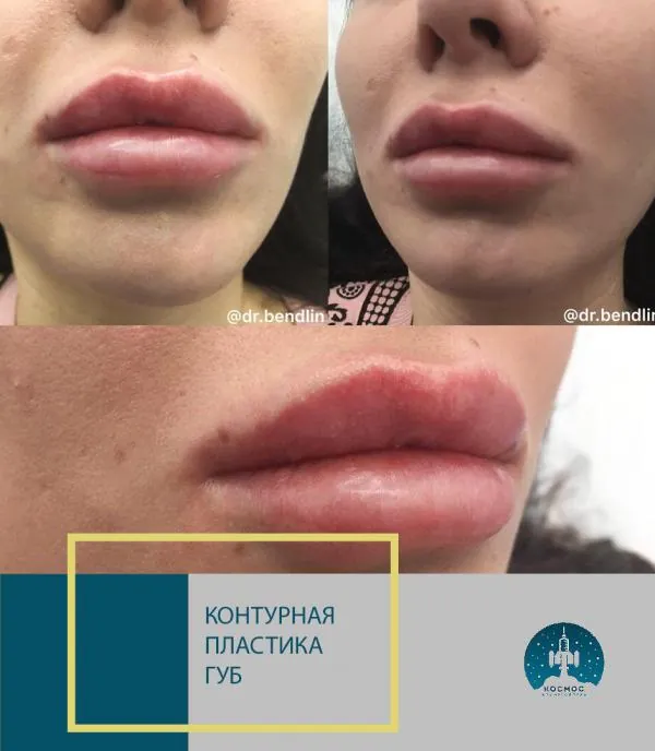 Губы