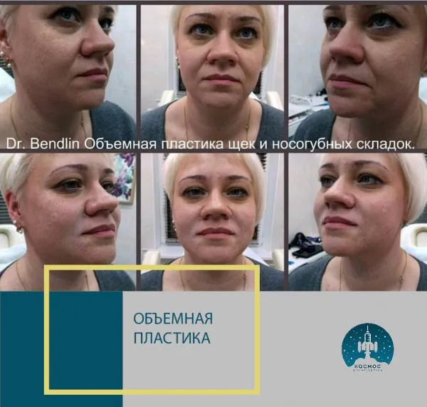 Объемная пластика