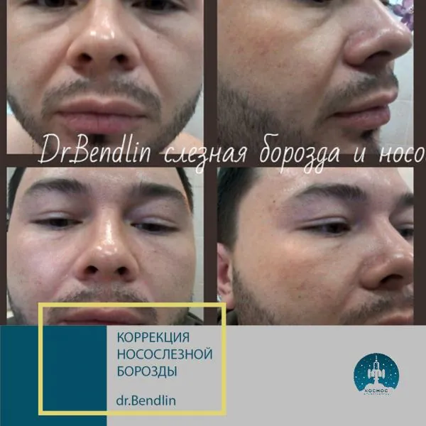 Фото до и после