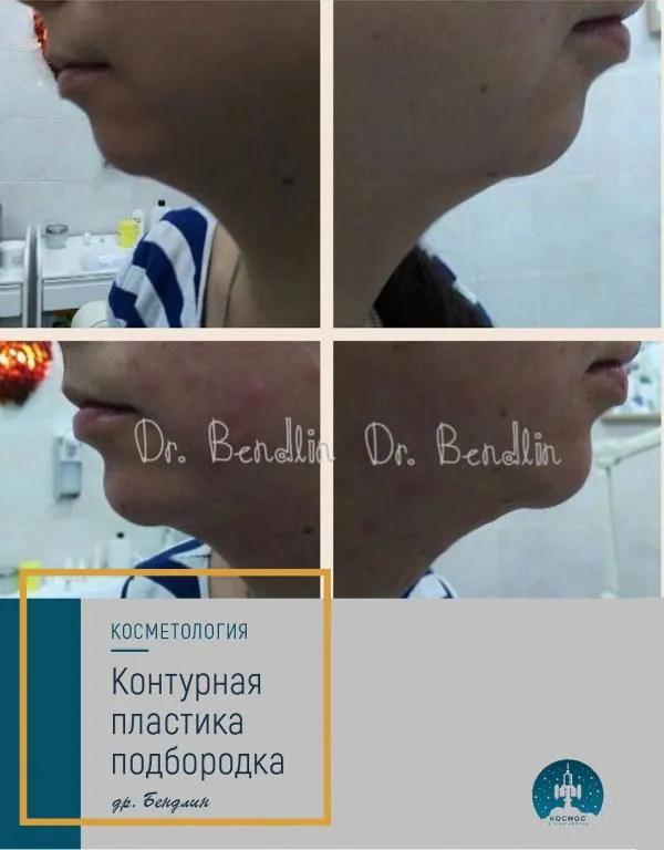 Подбородок