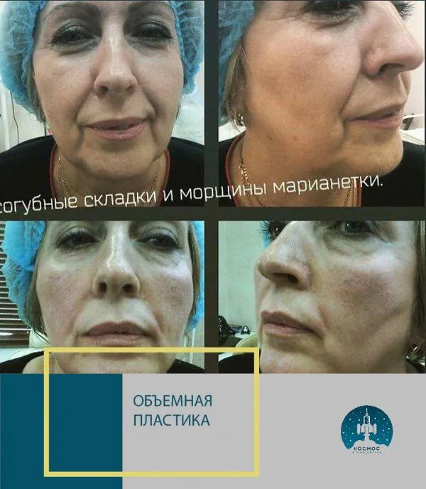Объемная пластика