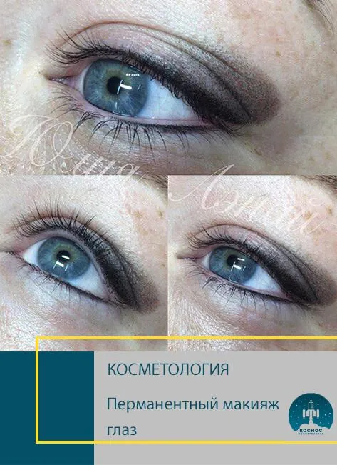 До и после процедуры