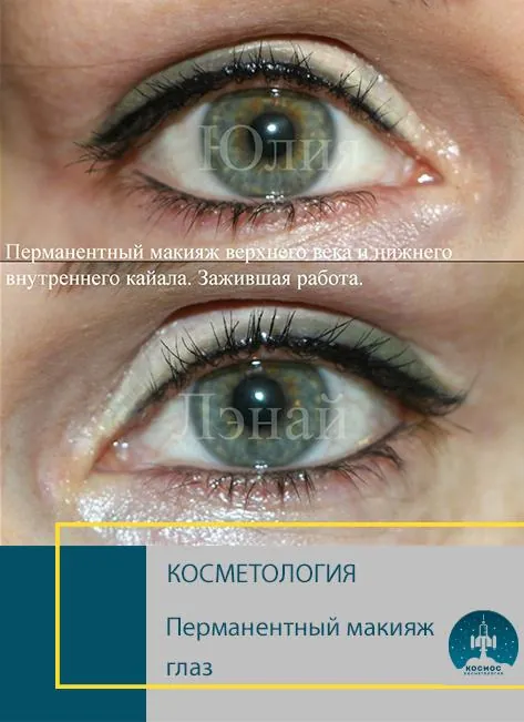 До и после процедуры
