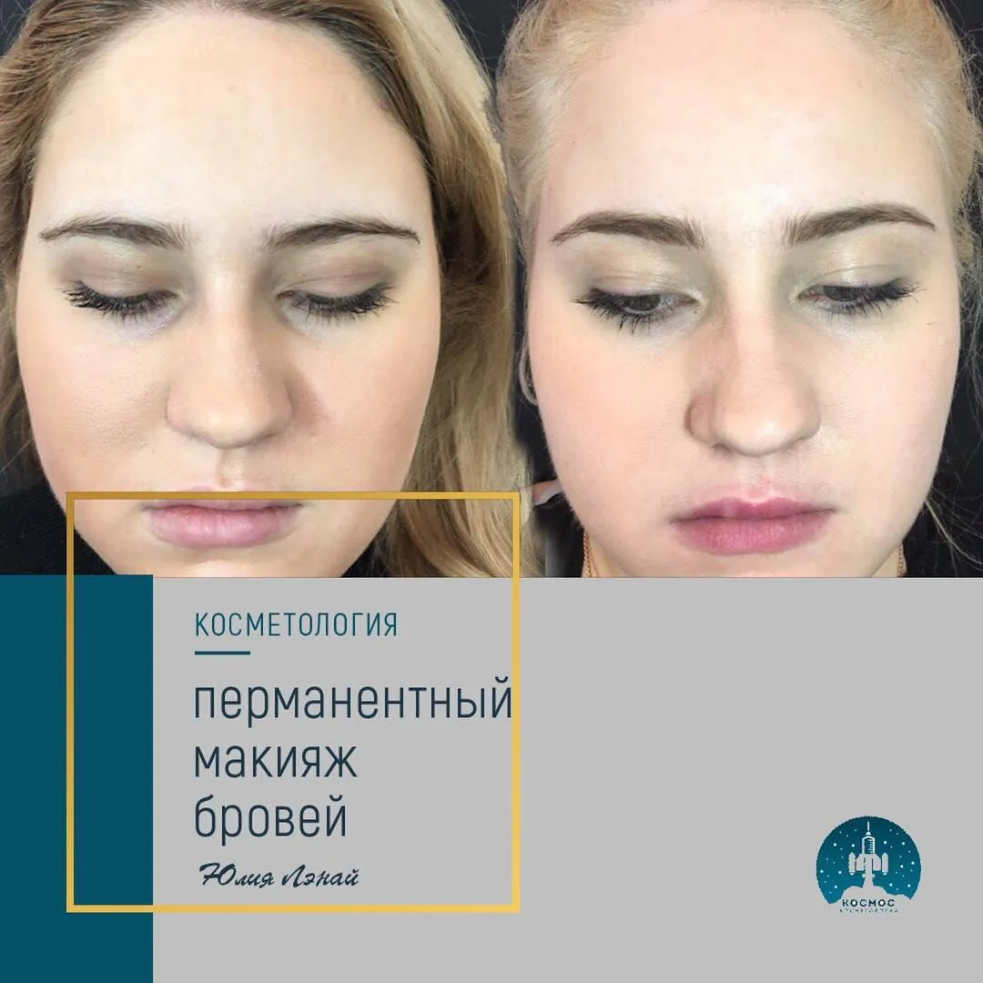 До и после процедуры